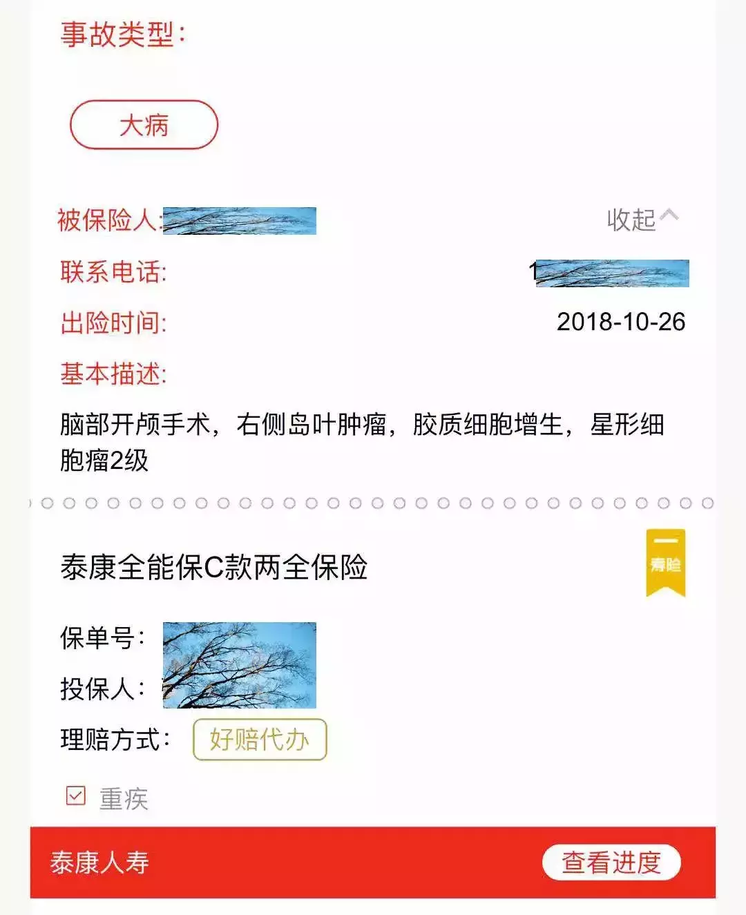 案例分享：脑胶质瘤理赔实录