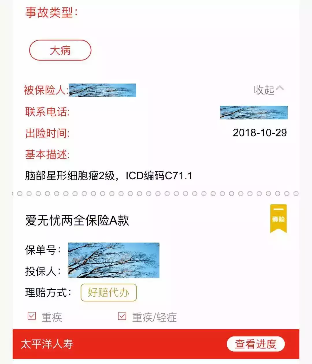 案例分享：脑胶质瘤理赔实录